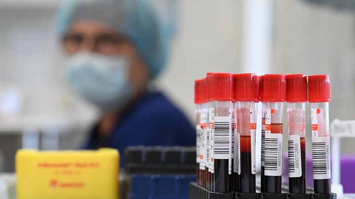 В России разработали новую методику, которая поможет в борьбе с тромбозом